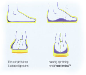 Formthotics støtte